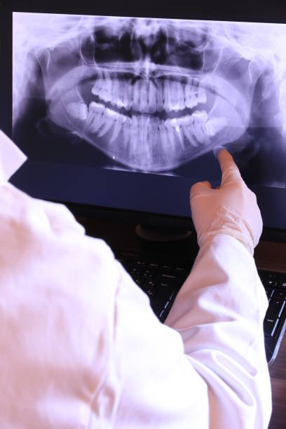 Best Emergency Tooth Extraction in Kingston, NJ